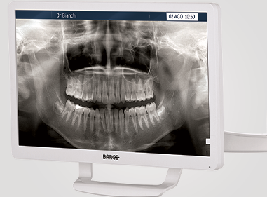Monitor Barco 22 (1)
